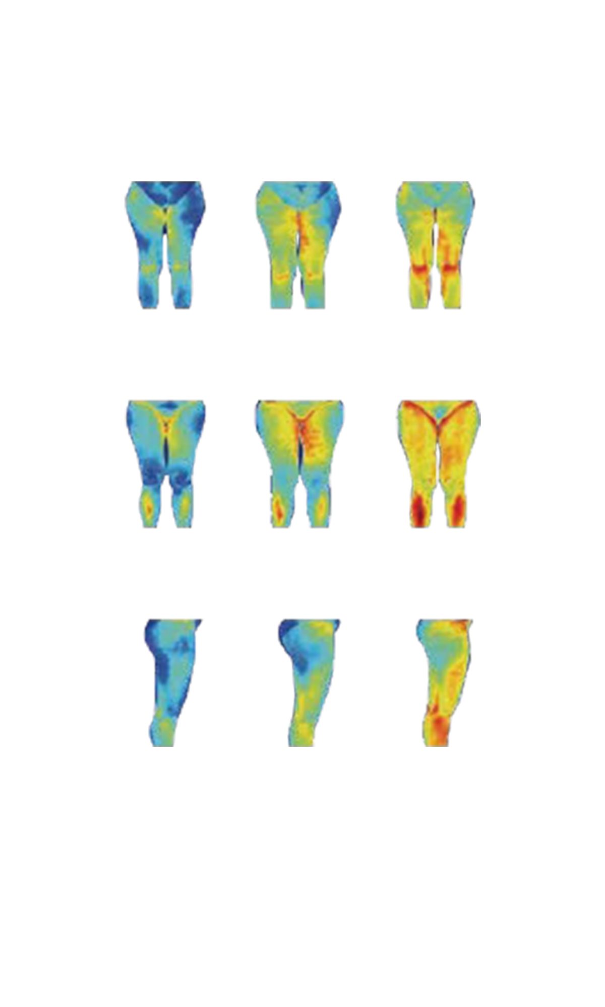 CROSS CALISTA IV ROLL BALL ENDOSFER + KIZIL ÖTESİ IŞIN Bölgesel İncelme, Selülit Bakımı, Yüz toparlama teknolojisi - Görsel 5